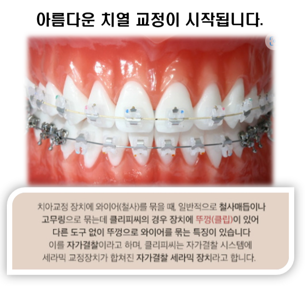 이미지명