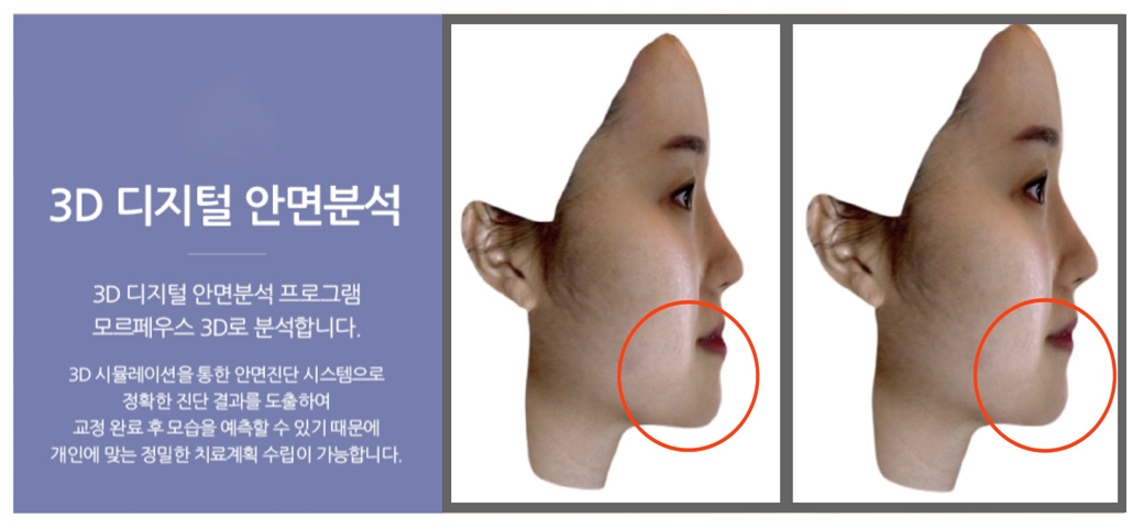 이미지명